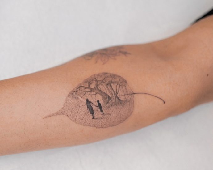 Tattoo Removal: How to, Costs, Before and After Pictures, and More